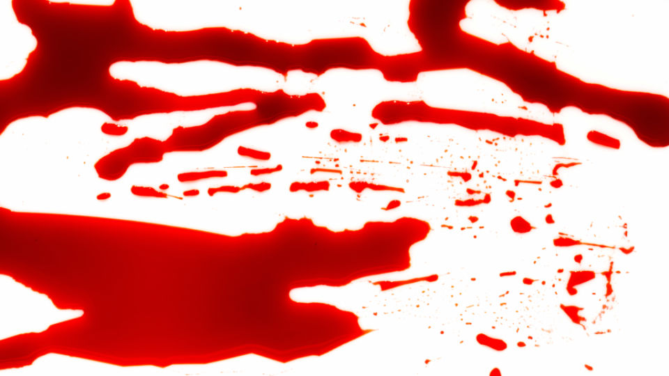 How to Make Fake Blood 25 Easy DIY Recipe List
